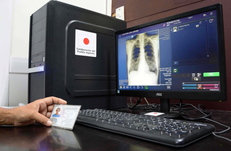 La calidad de las imágenes y la posibilidad de ampliarlas, cambiar contrastes, hacer mediciones y el ahorro de cientos de dólares cada semana en película fotográfica y químicos.