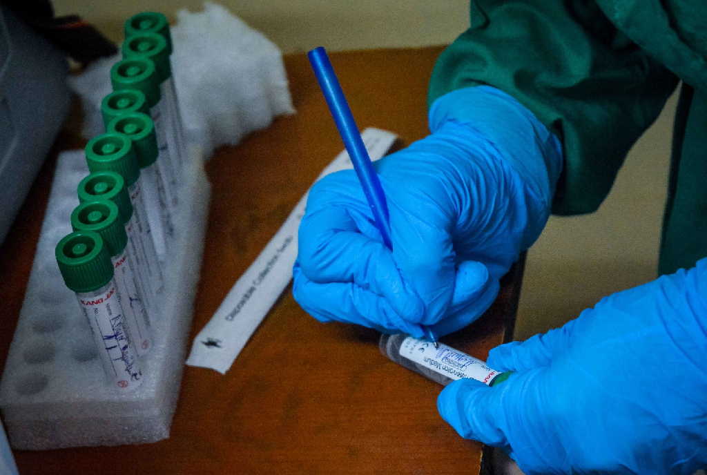 El Jefe Nacional Epidemiología del MINSAP, Dr. Francisco Durán, detalló que para la detección del virus se estudiaron la víspera 53 918 muestras y en la isla han analizado un total de 8 889 419 pruebas.